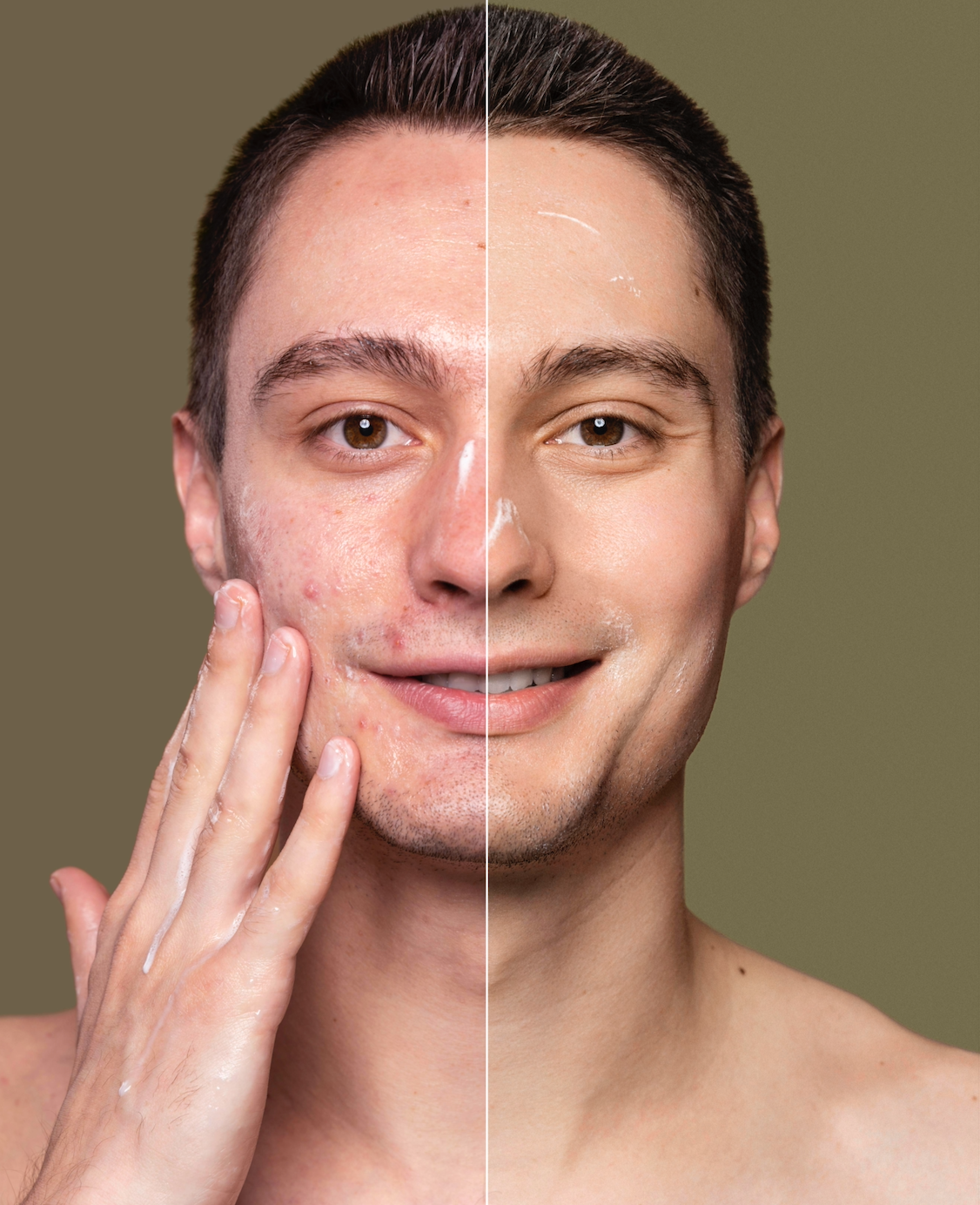 SKIN PURGE.